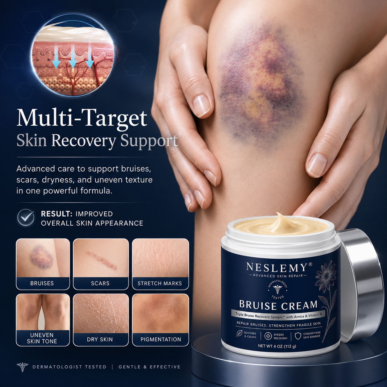 💥100K+ SOLD💕- NESLEMY® Bruise Repair & Skin-Strengthening Cream